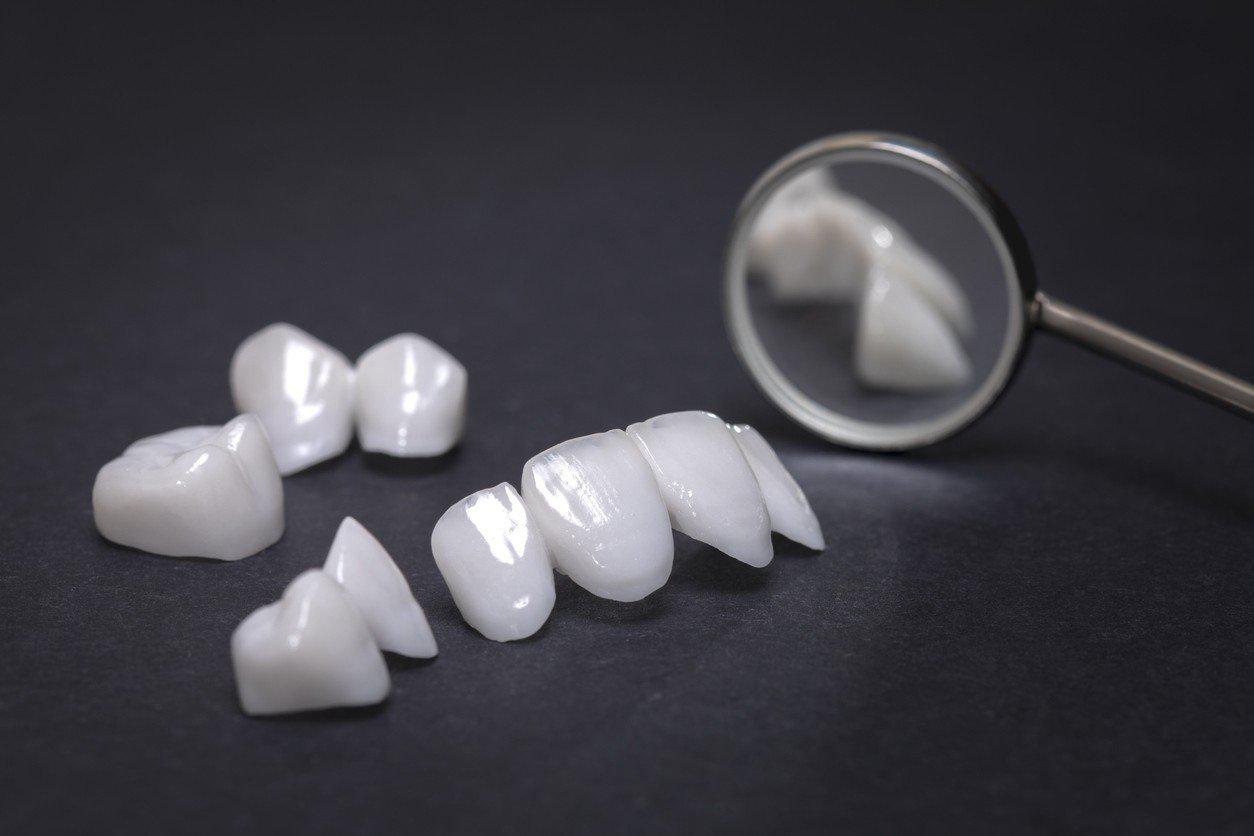 dental-implants-uk