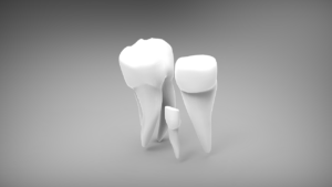 tooth implants - the history, how they've changed and the modern version of the dental implant