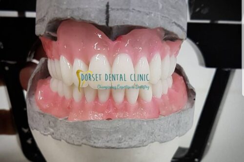 picture of prosthesis made by dentist